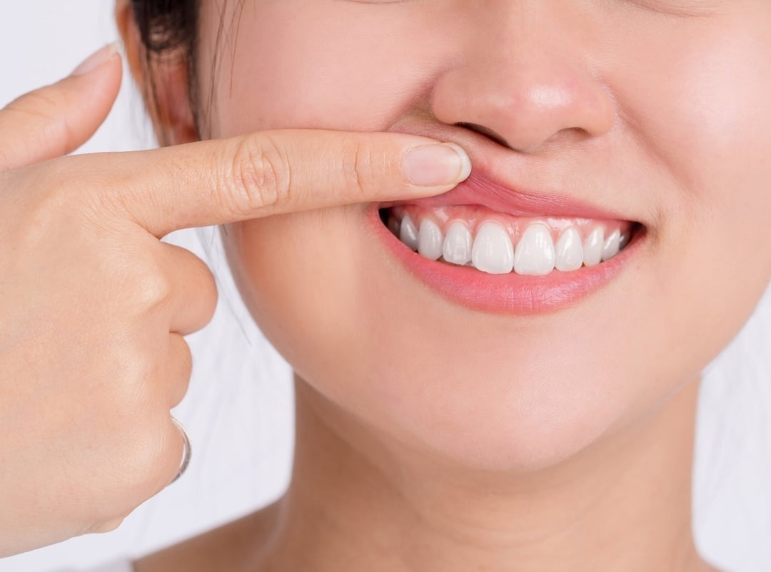 Periodontist